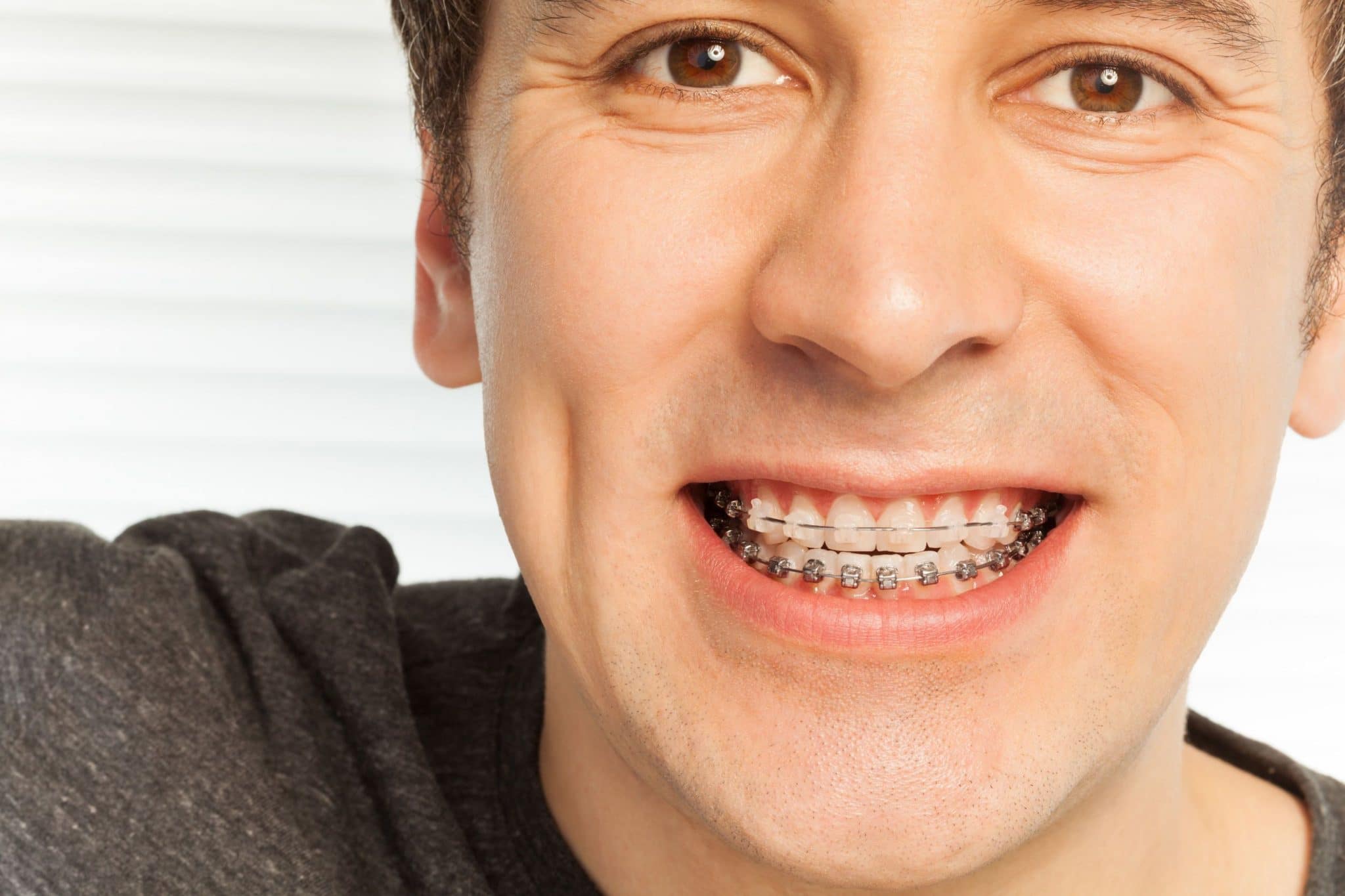 Adult man smiling to show metal braces