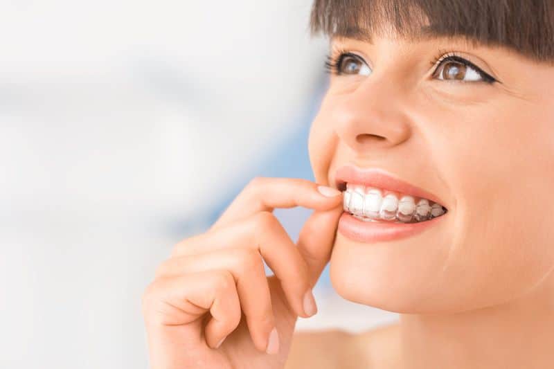 Smiling woman with bangs removing clear Invisalign aligner from upper teeth