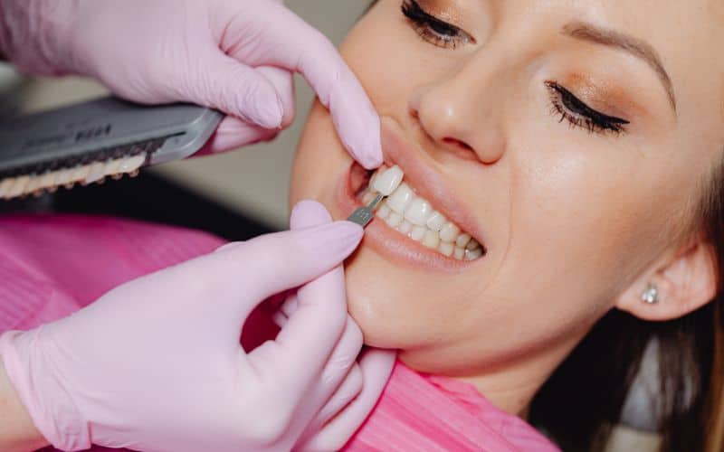 Dentist carefully placing dental veneers onto a patient's teeth,