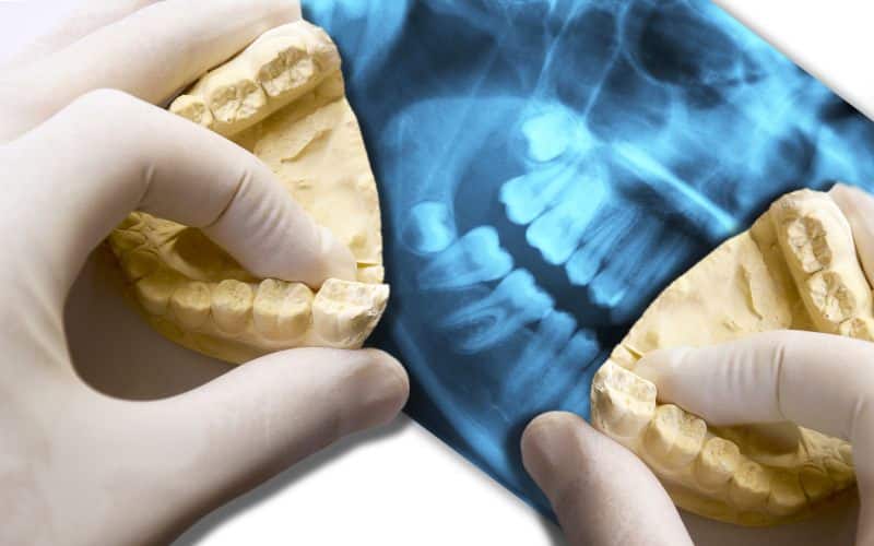 hands-show-molar-teeth-over-x-ray-dental-scan