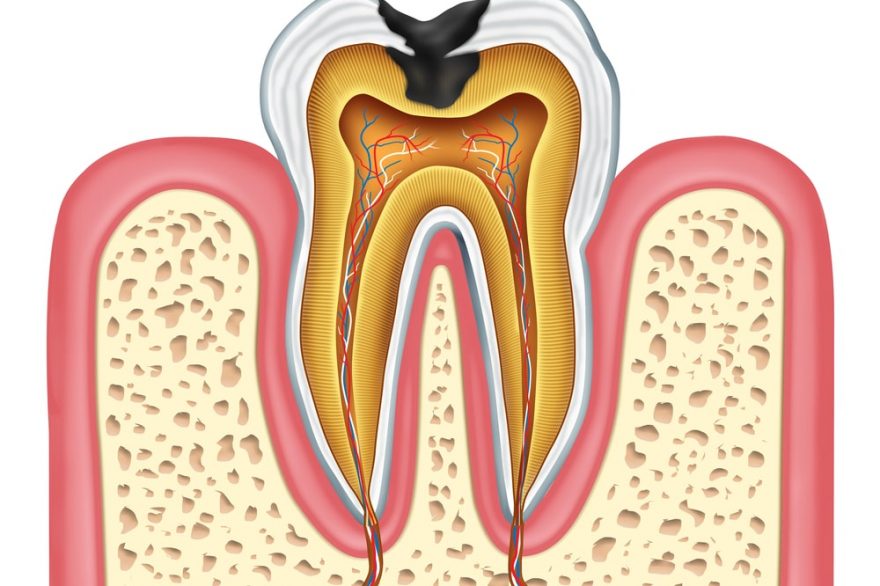 Tooth inner anatomy diagram