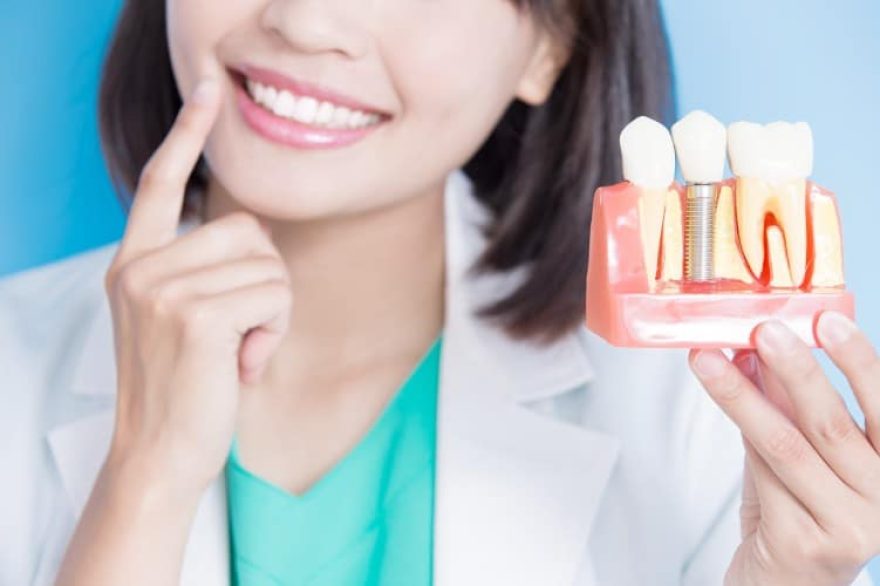 dentist with implant tooth model