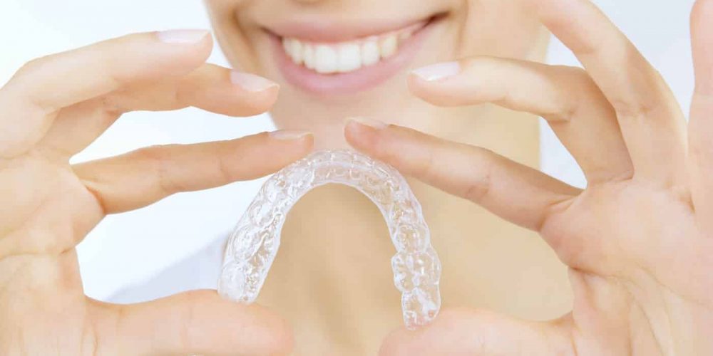 What are Invisalign Clear Braces? - Stoney Creek Dental